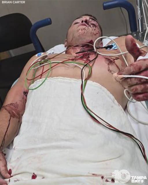 A Story of Survival and Strength: Ethan Carter’s Miraculous Recovery After Alabama Shooting